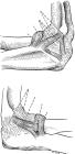 thumbs/33.jpg